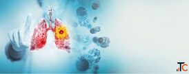 Lung Cancer Treatment in Delhi