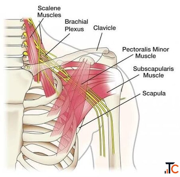 Brachial Plexus Injury Treatment in Gurgaon Expert Physiotherapy Nerve Rehabilitation