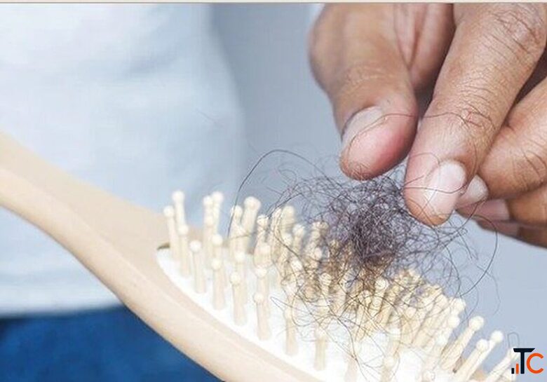 Hair Loss Treatment in Gurgaon Aesthetics Redefined