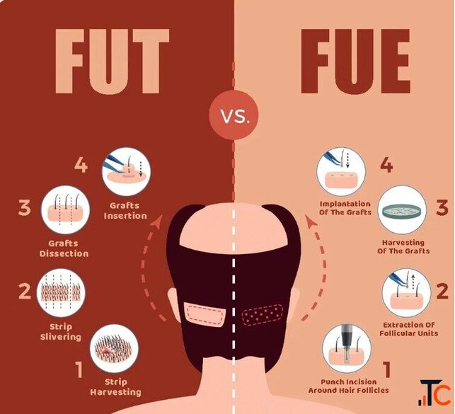 Hair Loss Treatment in Gurgaon Aesthetics Redefined