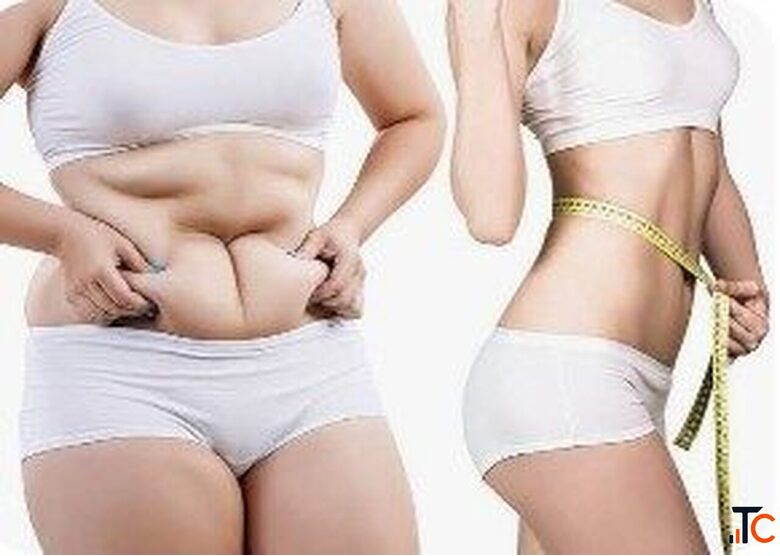 Tummy Tuck Surgery Near DLF Phase Area Gurgaon