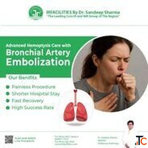 Bronchial Artery Embolization Radiology State-of-the-Art Image-Guided Interventions