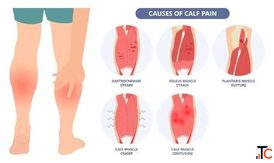 Calf Strain Treatment in Gurgaon Expert Physiotherapy for Fast Recovery
