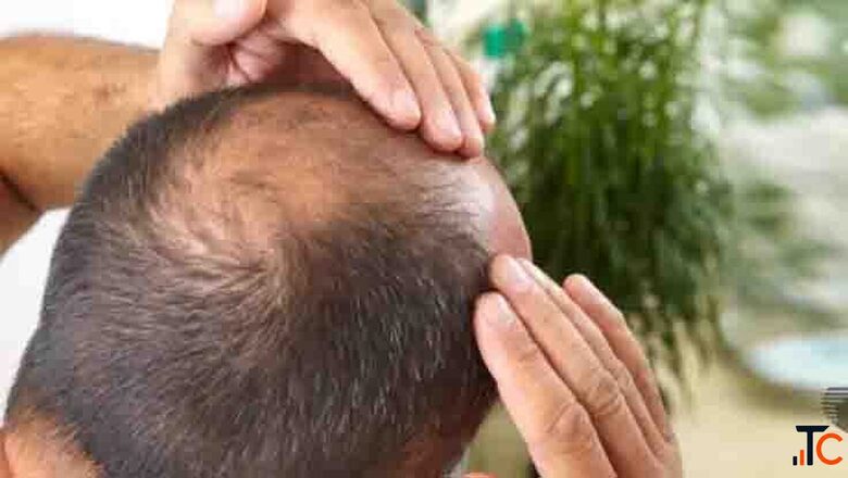 Best Skin Hair Care Treatment Clinic in Coimbatore