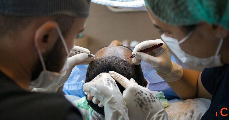 Get Exceptional Results with the Best Hair Transplant Surgeon in Delhi