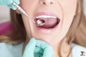 Dental Implants in Oxnard - A Lasting Solution for Missing Teeth