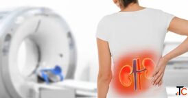 Kidney Disease Early Signs You Shouldn't Ignore