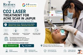 Acne Scar Assessment CO2 Laser Treatment in Jaipur