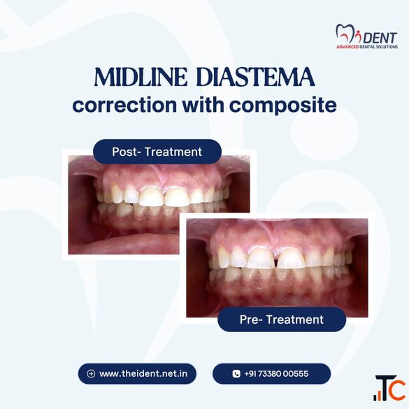Award Winning Dentist in Hoskote Complete Oral Care Solutions