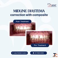 Award Winning Dentist in Hoskote Complete Oral Care Solutions