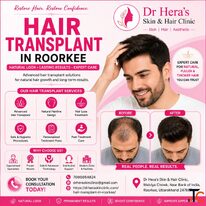 Professional Hair Transplant In Roorkee Near You