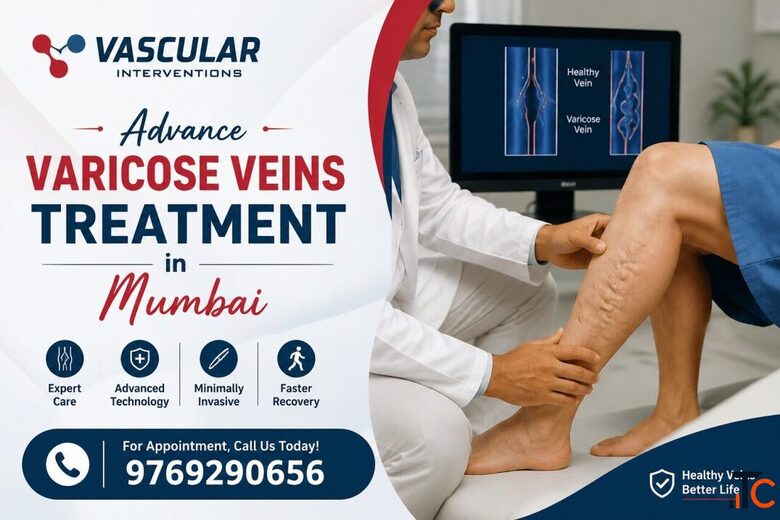 Professional Varicose Veins Treatment with Personalized Care