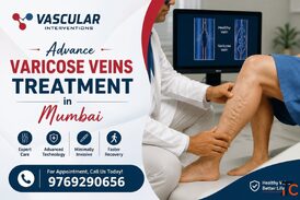 Professional Varicose Veins Treatment with Personalized Care