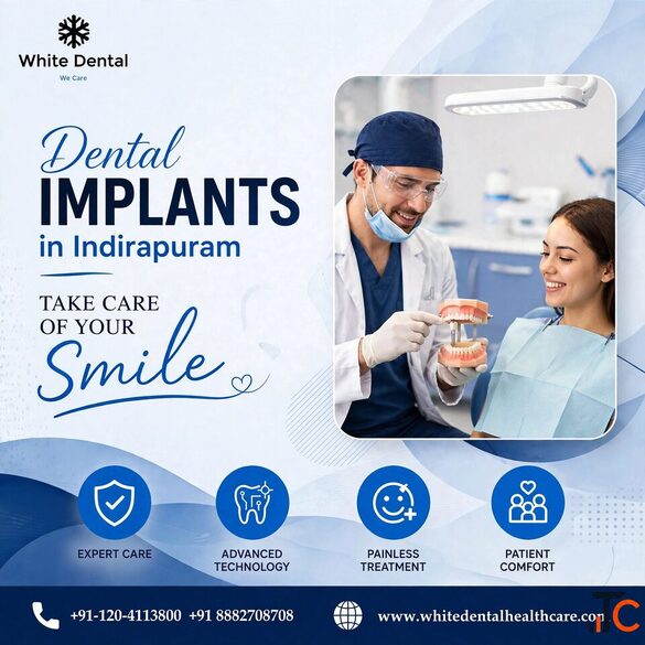 Dental Implants in Indirapuram for Missing Teeth