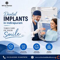 Dental Implants in Indirapuram for Missing Teeth