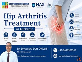 Arthritis Treatment in Lucknow Dr. Divyanshu Dutt Dwivedi