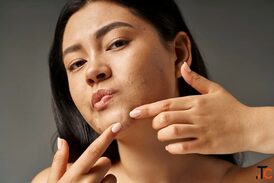 Chemical Peel Treatment in Nagpur for Clearer Healthier Skin