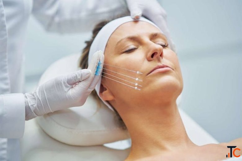 Advanced Thread Lift Treatment in Delhi