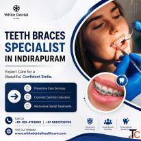Teeth Braces Specialist in Indirapuram for Perfect Smiles