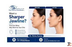 Want a Sharper Jawline Find Out What May Work for Your Chin
