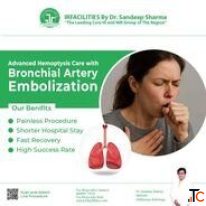 Arterial Embolization State-of-the-Art Minimally Invasive Vascular Procedure