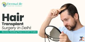 Hair Transplant in Delhi - Dr. Gaurav Garg at Dermalife FUE Boosted FUE