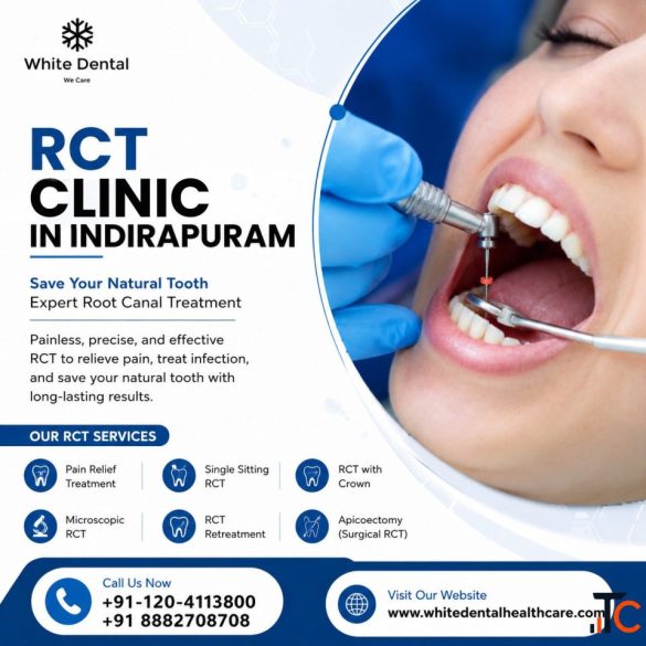 RCT Clinic in Indirapuram for Root Canal Care