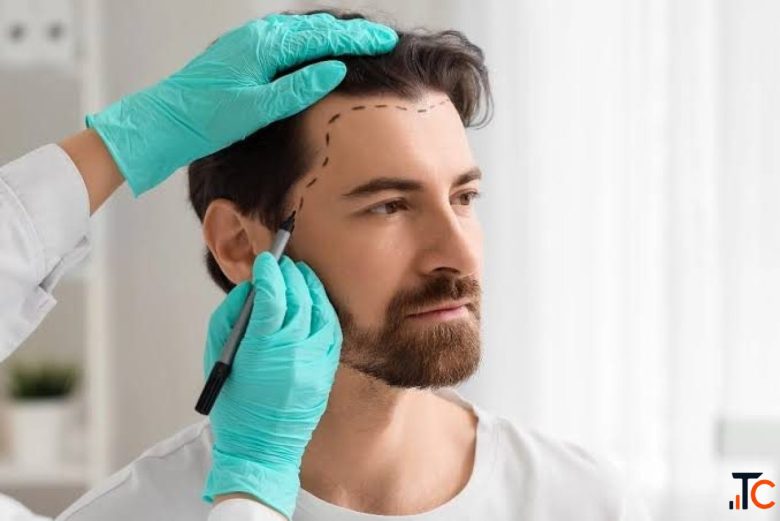 Get Smooth Scalp Fuller Hair with The Botox Hair Treatment