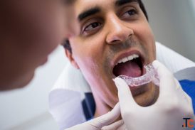 Best Invisalign Treatment Affordable Invisalign Treatment In Madurai - Zaara Dentistry