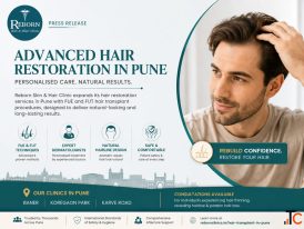 Hair Transplant Cost in Pune What Determines the Price