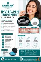 Do Your Teeth Need Invisalign Signs You May Need Invisalign Treatment in Kondapur