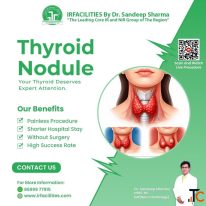 Thyroid Nodule Treatment in India without Surgery - Modern Approach