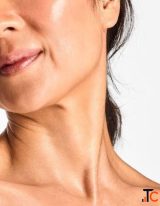 Neck Tightening in Glendale AZ