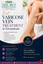 Best Varicose Vein Treatment in Trivandrum NIMS Micro Hospitals
