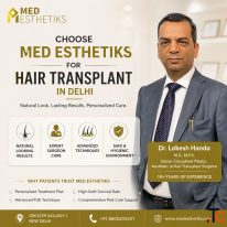 Restore Your Hair Naturally with Hair Transplant in Delhi