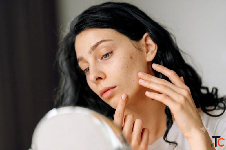 Best Face Rejuvenation Facelift Surgery in Coimbatore