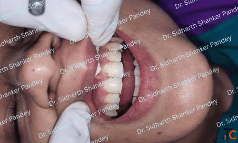 Pandey Dental Clinic - Complete Care For Every Smile