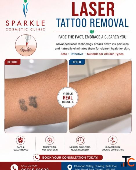 tattoo removal in mira road