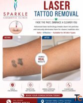 tattoo removal in mira road