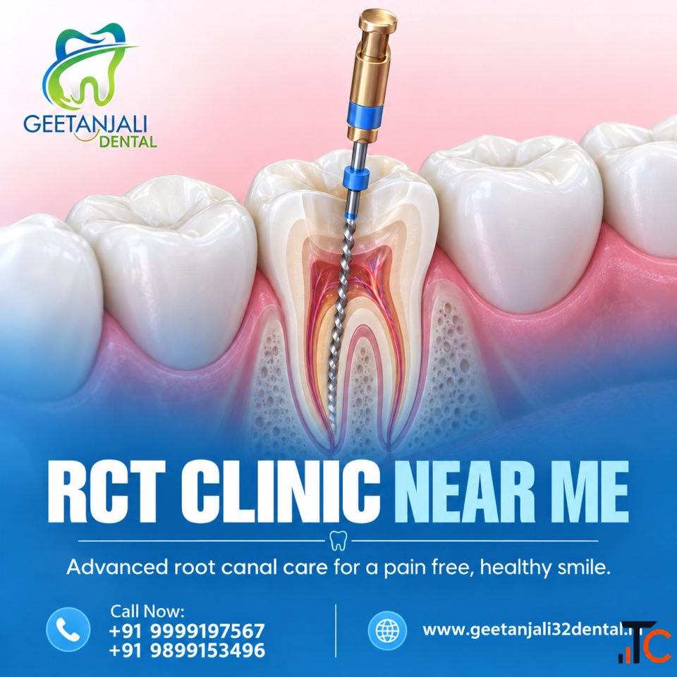 RCT Clinic Near You for Comfortable Root Canal Treatment