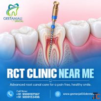 RCT Clinic Near You for Comfortable Root Canal Treatment
