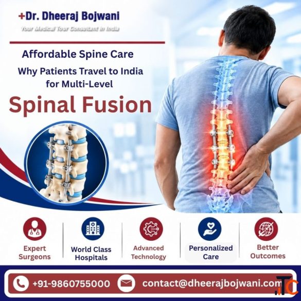 Affordable Cost of Spinal Fusion Surgery in India