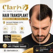 Speak With a Hair Restoration Specialist in Electronic City Today Clarivskin.in
