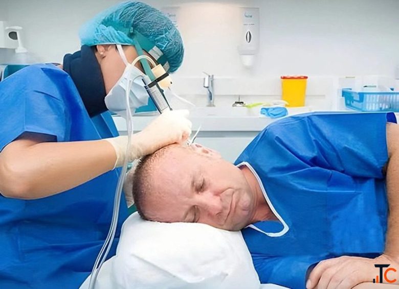 Hair Transplant in Noida Everything You Need to Know Before Getting Started
