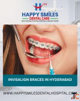 Invisalign Braces in Vanasthalipuram for a Confident Smile