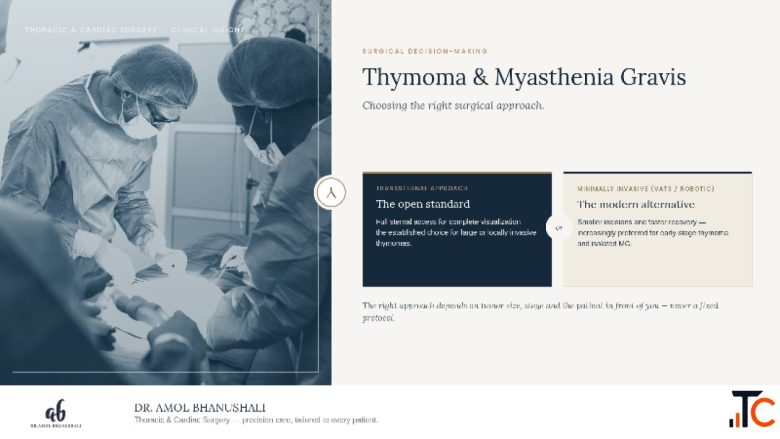 Thymoma Myasthenia Gravis Choosing the Right Surgical Approach