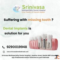 Best Dental Implants in Kakinada - Srinivasa Multispeciality Dental Hospital