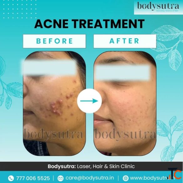 Dermatologist in PCMC for Advanced Skin and Hair Treatmen