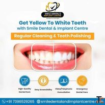 Affordable Teeth Cleaning in Hyderabad - Smile Dental and Implant Centre