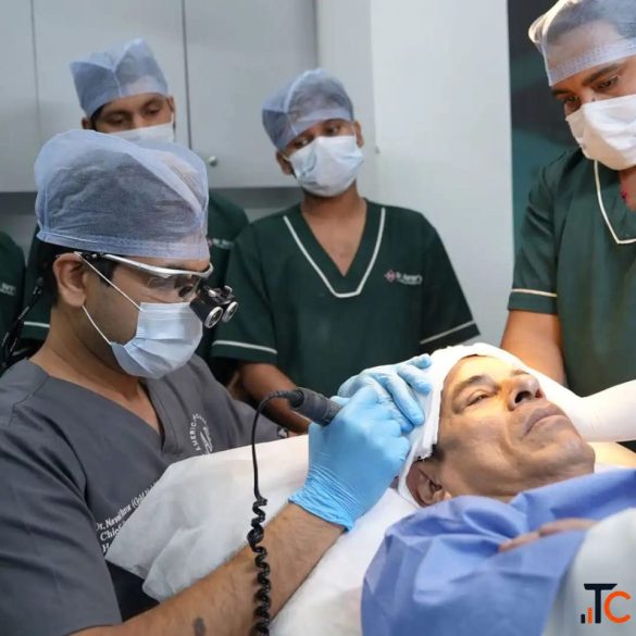 Trust the Best Hair Transplant Surgeon for Your Scalp